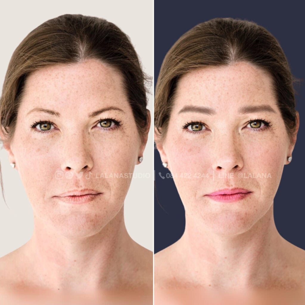 เคล็ดลับหน้าเด็ก ด้วยการเพิ่มคอนทราส